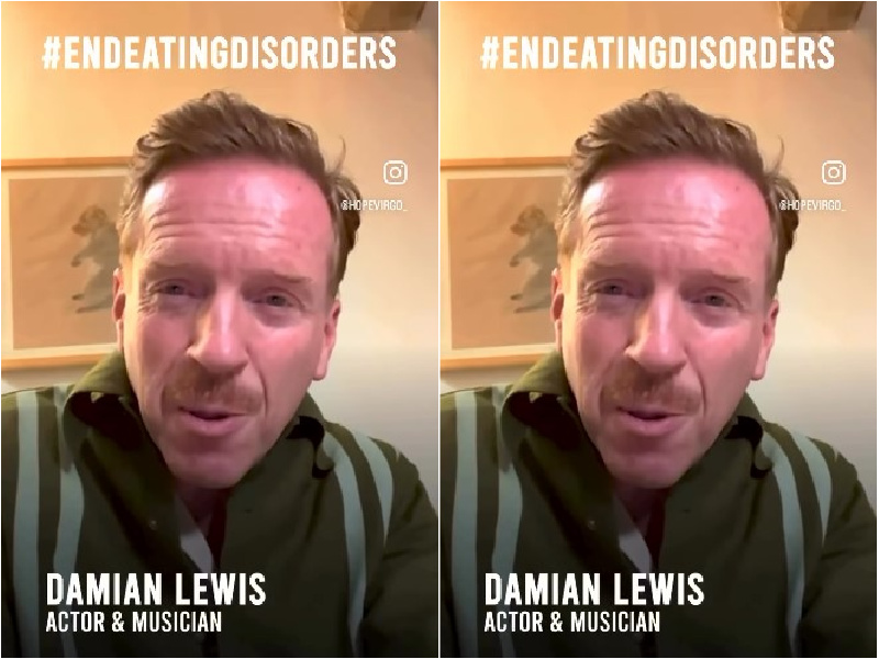 Damian Lewis Campaigns For Dump the Scales Movement